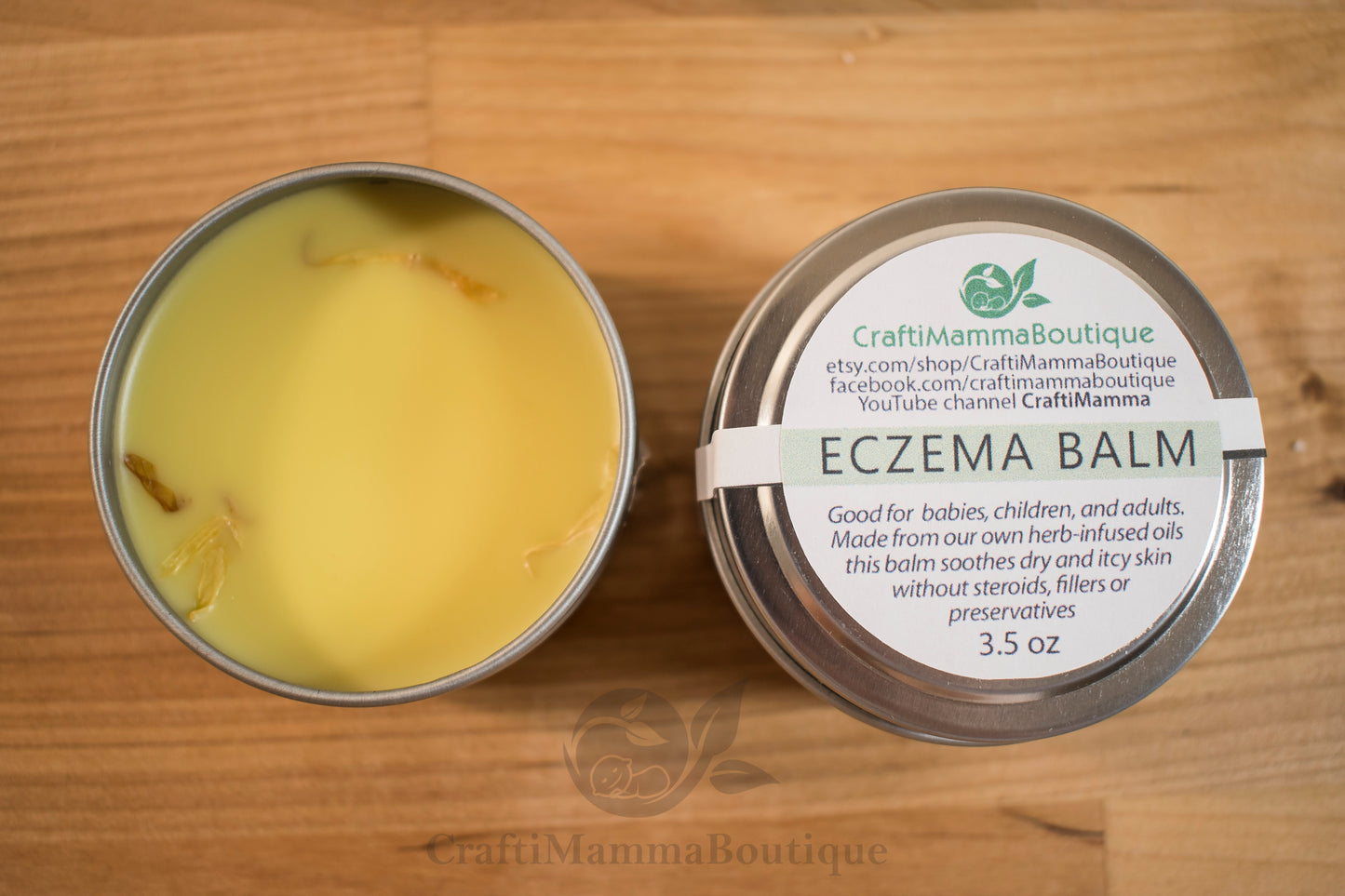 Soothing Herbal Eczema Balm – Plantain, Calendula & Rosemary Infused for Natural Skin Relief