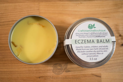 Soothing Herbal Eczema Balm – Plantain, Calendula & Rosemary Infused for Natural Skin Relief